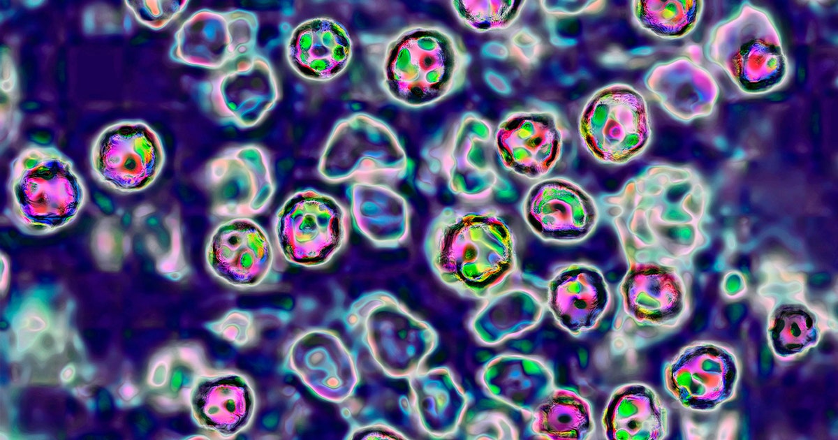 Measles in Wisconsin: 2 lab-confirmed cases in Vernon County