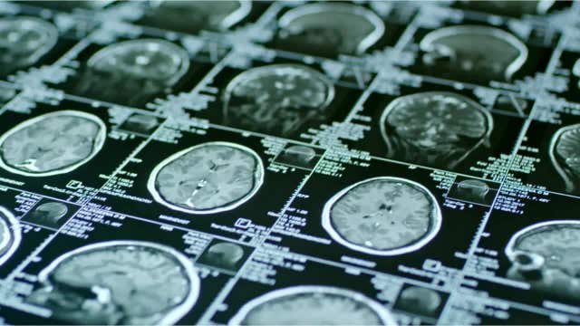 Walk for Thought 2025: Minnesota Brain Injury Alliance honors survivors at Long Lake Regional Park