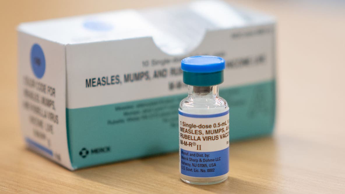 Minnesota measles cases reach 80, highest since 1990
