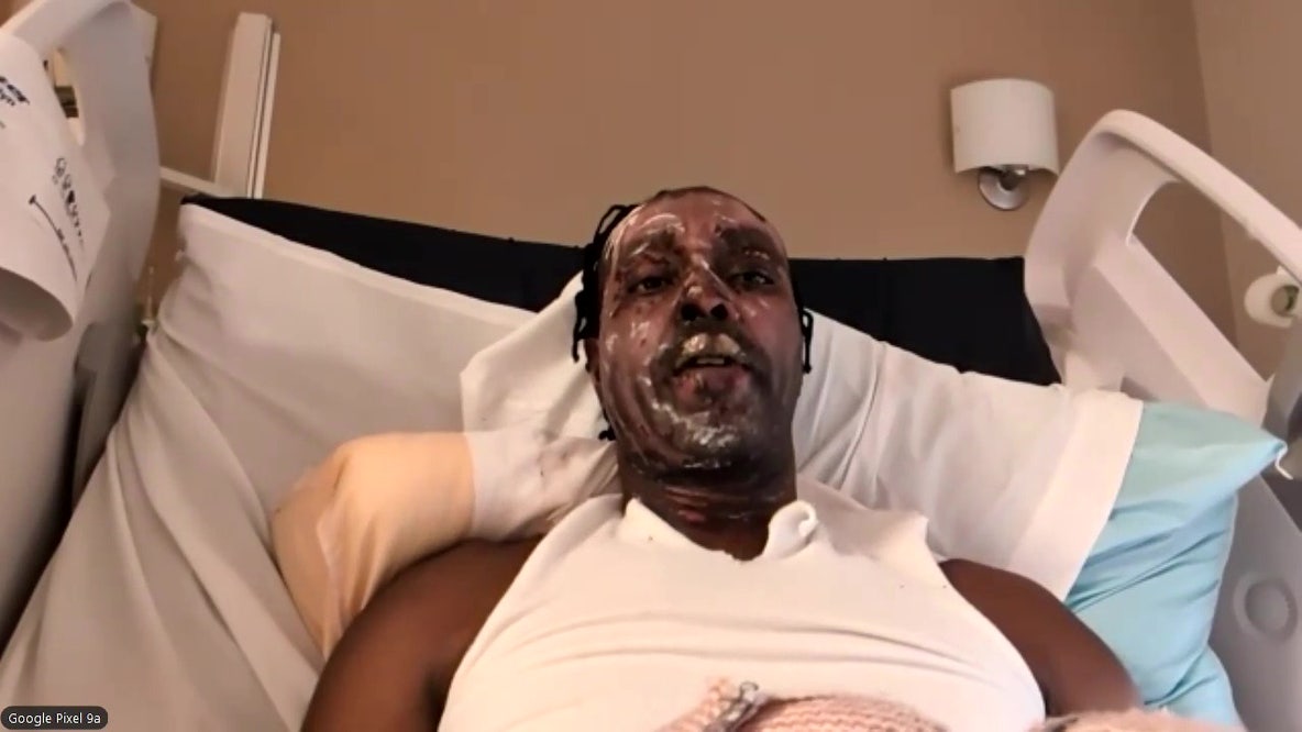 Food truck owner recovering after explosion: ‘Blessed I’m still here’