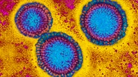 Flu hospitalizations 'slightly higher' than usual, officials urge vaccinations
