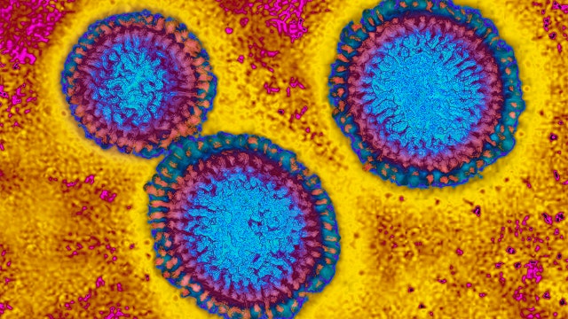 Flu hospitalizations 'slightly higher' than usual, officials urge vaccinations