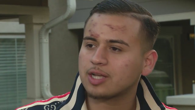 Popular musician claims police brutality following house party, arrest in San Bernardino