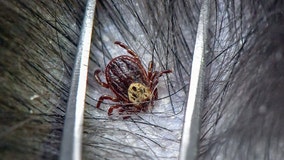 Tick bites leave 5-year-old girl hospitalized, unable to swallow or move amid ‘tick paralysis’