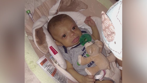 Whittier baby in dire need of new liver
