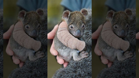 Adorable orphaned baby koala gets arm cast after falling from tree