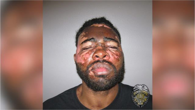 Woman threw pot of boiling hot grease in face of alleged burglar, police say