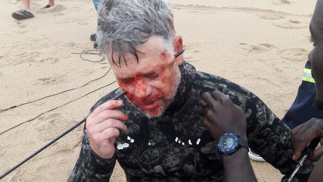 Man survives after shooting himself through head with speargun in diving accident