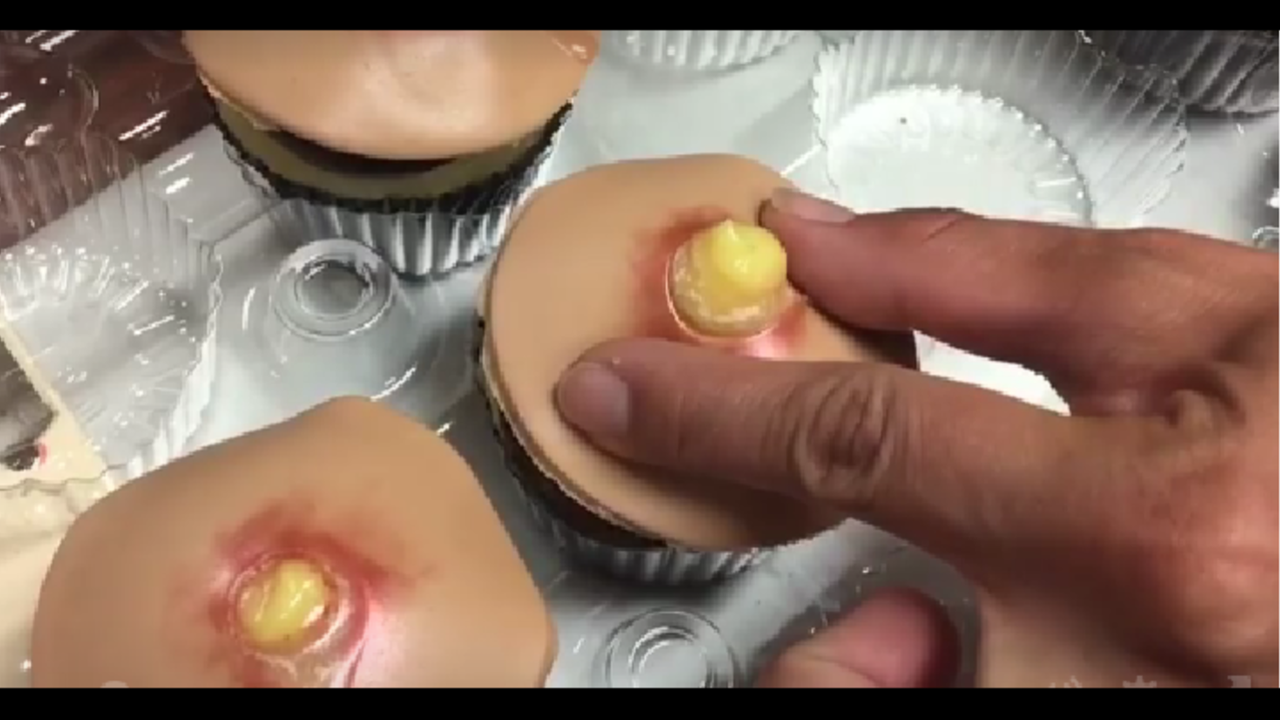 moeilijk slachtoffer overschreden Would you eat these pimple-popping cupcakes?
