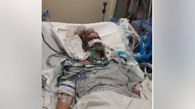 Riverside police seek public's help in deadly Riverside park assault