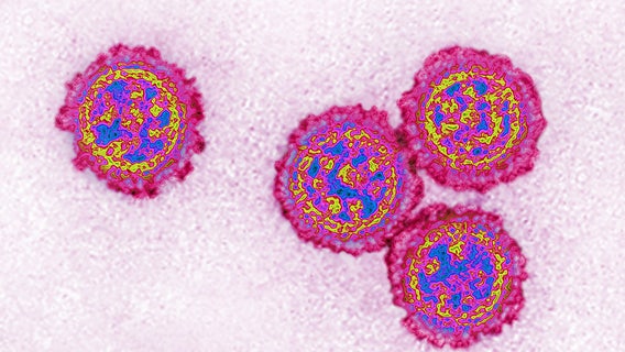 Long Beach confirms city's first flu death of season