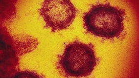 Culver City resident tests presumptive positive for COVID-19 coronavirus