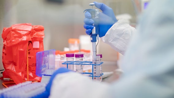 5th case of COVID-19 confirmed in Long Beach, first known case of community transmission