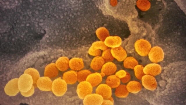 Orange County reports 141 new coronavirus cases, 14 additional deaths