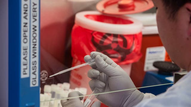 UCLA receives $1M for COVID-19 Rapid Response Initiative