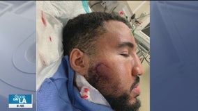 ‘I felt like I was on the timeline to my death’: Local man speaks out after weekend protest ends in violence