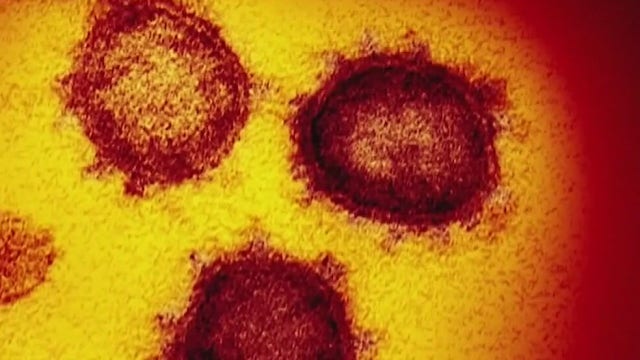 Riverside County sees biggest one-day spike in COVID-19 cases