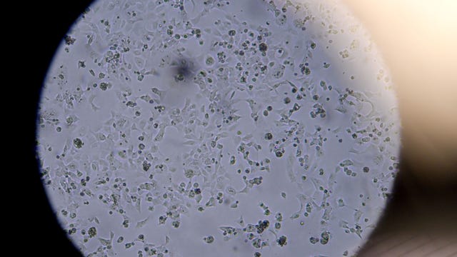 Beyond fever and shortness of breath, experts say COVID-19 symptoms can appear in unusual ways