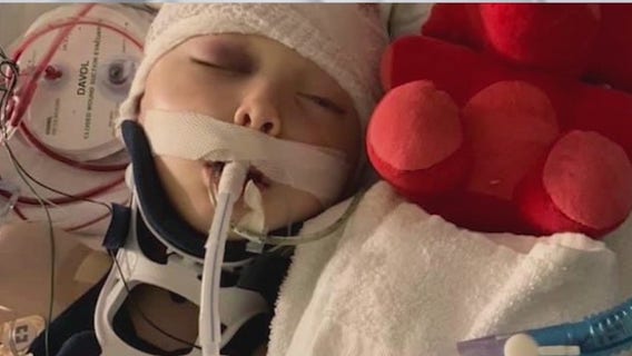 7-year-old remains in coma, suspect accused in 'random' attack charged with attempted murder