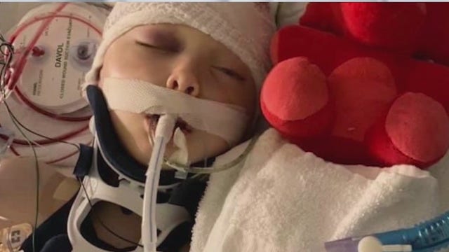 7-year-old remains in coma, suspect accused in 'random' attack charged with attempted murder