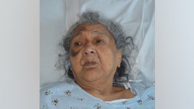 Health officials seek help identifying South Bay patient