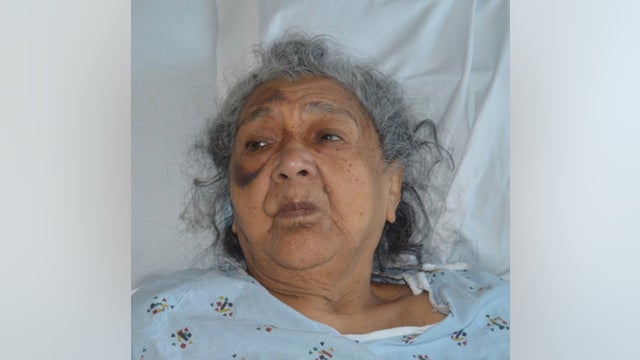 Health officials seek help identifying South Bay patient