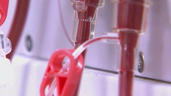 Prop 23: How it affects the future of dialysis clinics and ultimately, patients