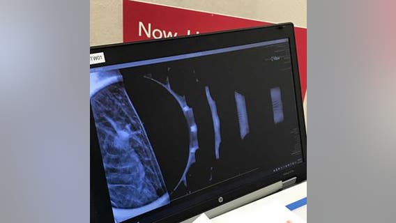 ‘Next big wave’: Radiation drugs track and kill cancer cells