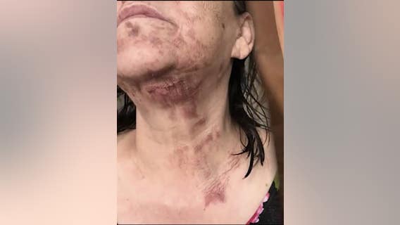 Mother of late singer Jenni Rivera sues NutriBullet, claims it 'exploded' on her