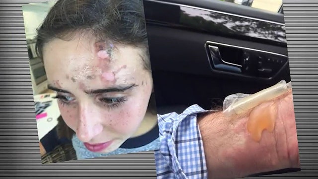 Feds reportedly investigating allegations of exploding NutriBullets; more victims come forward