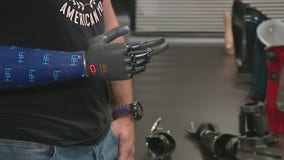 Westlake Village prosthetics company tests state-of-the-art bionic arm