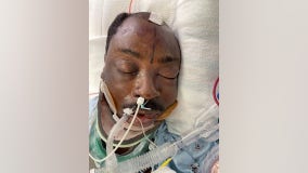 Officials need help identifying ICU patient struck by car while riding bike along the PCH