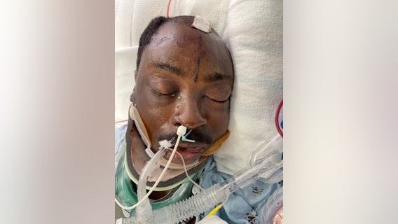 Officials need help identifying ICU patient struck by car while riding bike along the PCH