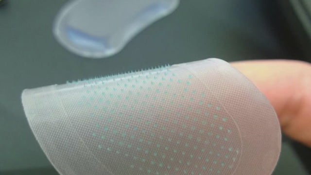 UCI looking into developing COVID-19 patch as alternative to needle form of vaccine