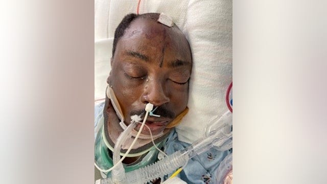 Officials need help identifying ICU patient struck by car while riding bike along the PCH