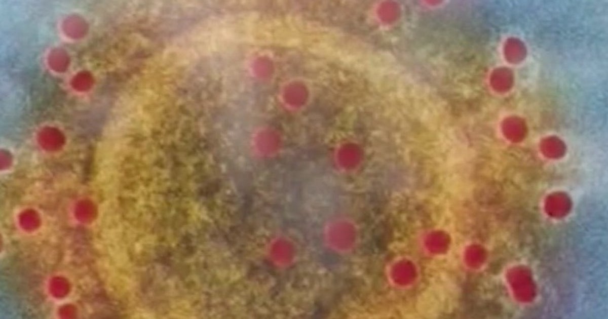 Health officials confirm first case of COVID-19 UK variant in Pasadena ...