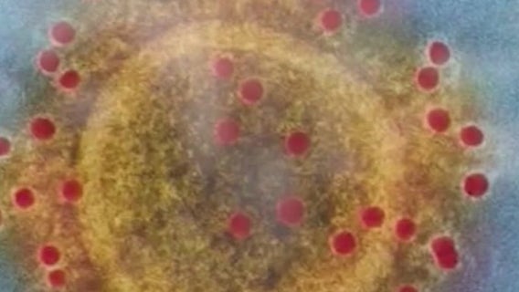 Health officials confirm first case of COVID-19 UK variant in Pasadena