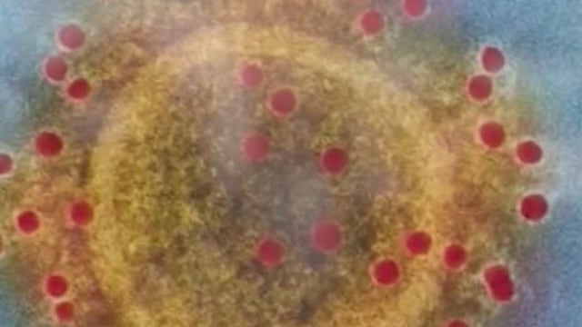 Health officials confirm first case of COVID-19 UK variant in Pasadena