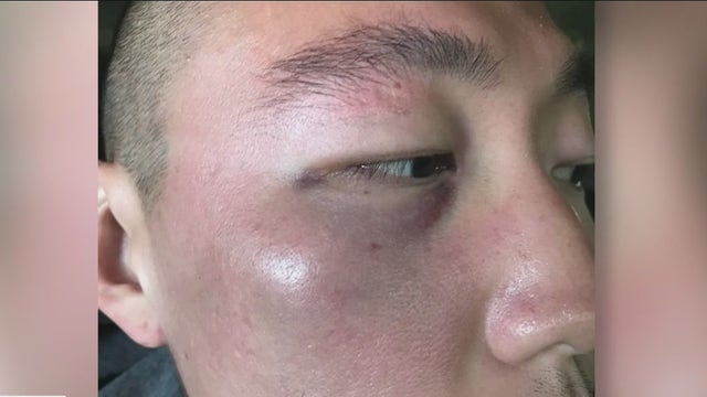 Alleged attack against man in Koreatown part of growing trend of Asian American hate crimes