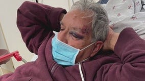 'My dad didn't deserve this': Elderly man victim of suspected random attack in Baldwin Park