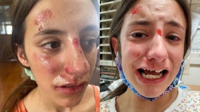 Illinois 7th grader says school bully attacked her during gym class