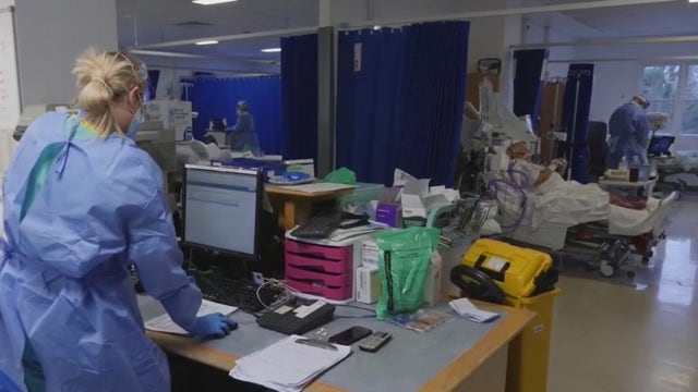 COVID-19: Local doctor discusses Delta variant that's worrying CDC