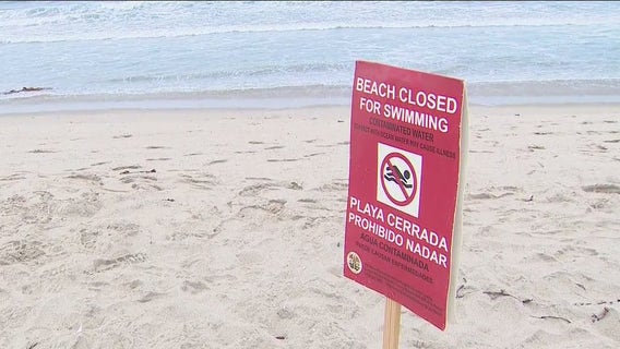 Sewage spill shuts down certain LA beaches to swimmers, surfers