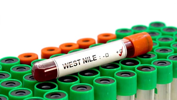 California DPH announces first West Nile virus death of 2021