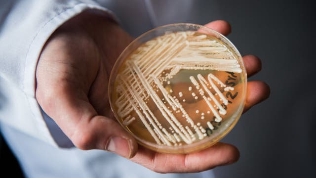 C. Auris superbug seen around US in clusters for ‘first time’, CDC says