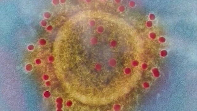 LA County reports more than 2,500 new COVID-19 cases, highest number since February