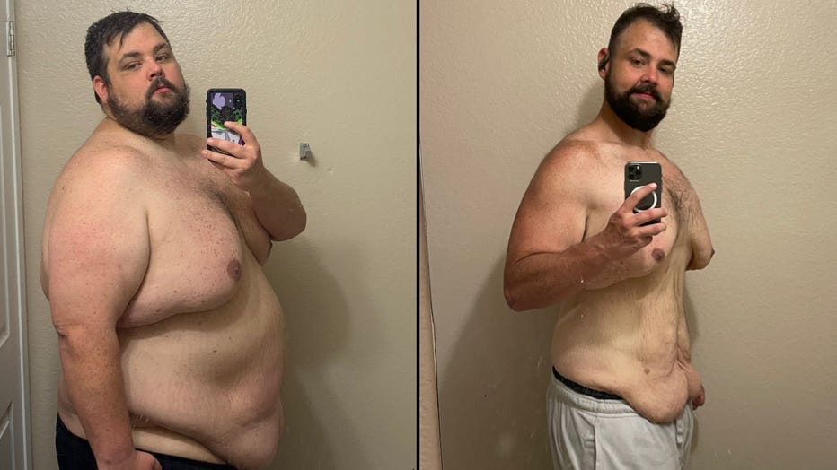 man-s-viral-240-pound-weight-loss-transformation-anything-s-possible