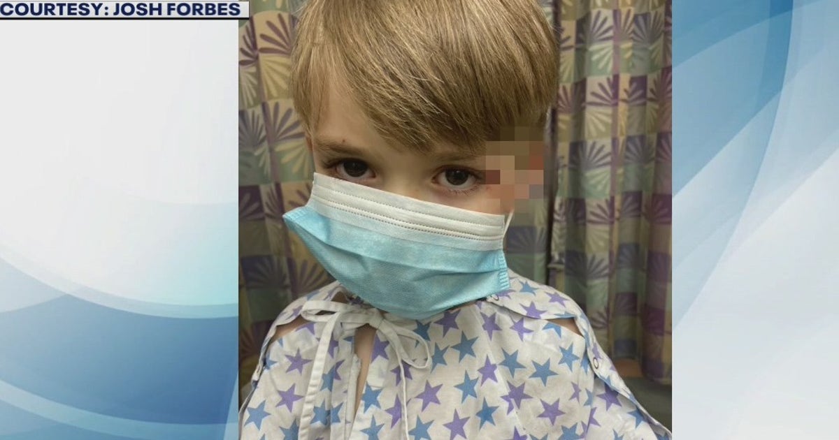 Boy with special needs hospitalized after being bitten by police dog ...
