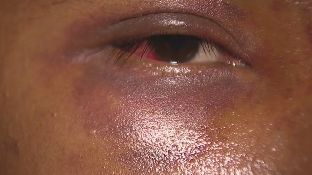 Surveillance video shows street vendor brutally beaten in San Bernardino