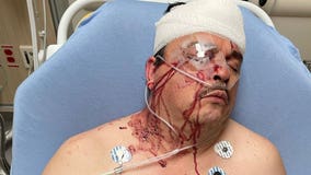 Lyft driver beaten bloody by two passengers in San Bernardino, victim claims